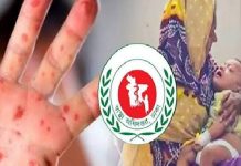 হাম উপসর্গে আরও ৬ শিশুর মৃত্যু