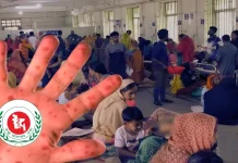 হাম উপসর্গে আরও ৭ মৃত্যু : মোট মৃত্যু ১ হাজার ১৯ জন